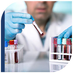 Lab Testing Near Me in Plymouth, MI and Bloomfield Hills, MI