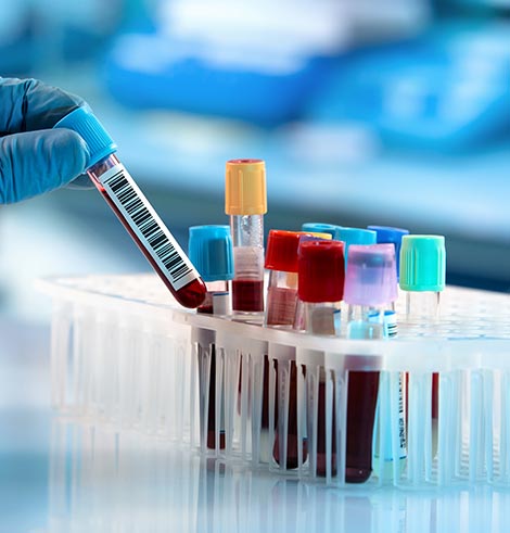 Lab Testing Near Me in Plymouth, MI and Bloomfield Hills, MI