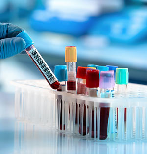 Lab Testing Near Me in Plymouth, MI and Bloomfield Hills, MI