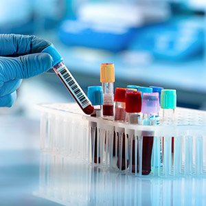 Lab Testing Near Me in Plymouth, MI and Bloomfield Hills, MI