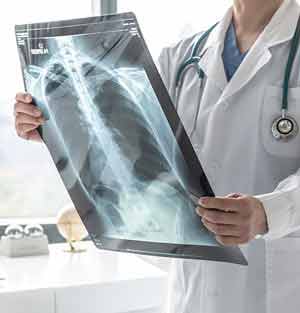 X-Ray Near Me in Plymouth, MI and Bloomfield Hills, MI